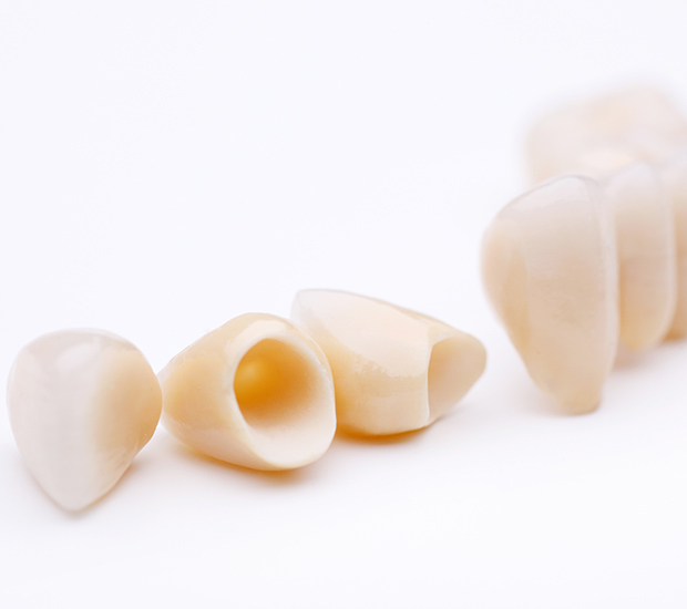 Grayslake Dental Crowns and Dental Bridges