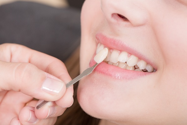What Is The Dental Restoration Process For Veneers?