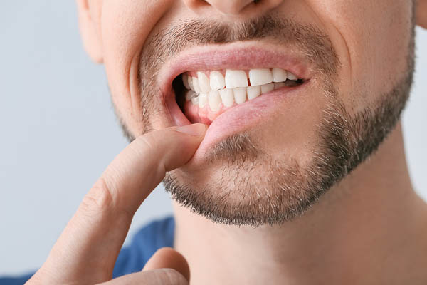 How Can I Prevent Gum Disease?