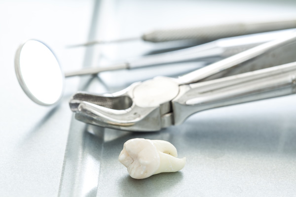Tooth Extraction Grayslake, IL